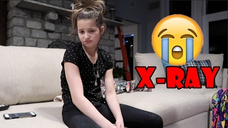 It's Time For an X Ray ? (WK 320) | Bratayley