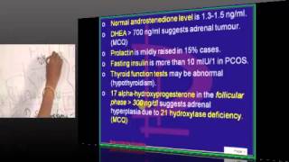 Gyn Obs Topic 32 pcod