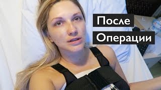 Пластический Дневник Naffy #3 | После ОПЕРАЦИИ| #сделалагрудь