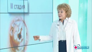 Здоровье. Женские болезни. Дисплазия шейки матки.  (21.01.2018)