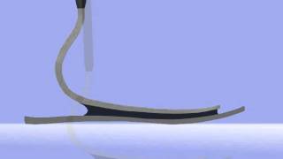The Axtion Foot by Otto Bock HealthCare