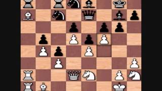 Anatoly Karpov vs Wolfgang Unzicker, 1974 Nice