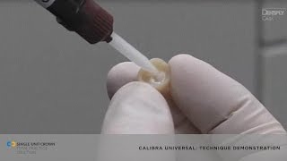 Watch a Demonstration on Using Calibra® Universal Self-Adhesive Resin Cement | Dentsply Sirona