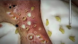 Tratamento Facial Brilhante para o Clientes #B0700 | Facial Treatment for Glowing Skincare