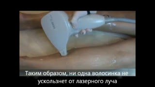 Лазерная эпиляция ног в центре Лайт Шер