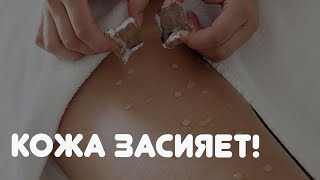 МАССАЖ ЛЬДОМ - ЗДОРОВАЯ И КРАСИВАЯ КОЖА!