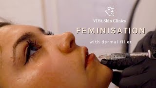 HOW TO LOOK MORE FEMININE? Feminisation Treatment with Dermal Fillers | VIVA Skin Clinics