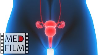 Акушерские кровотечения при гипотонии матки © Obstetric hemorrhage with hypotension uterus