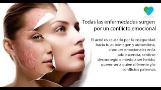 Meditación de sanción para curar el acné sin medicina