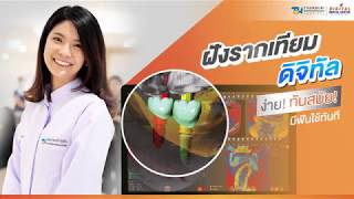 ฝังรากเทียมดิจิทัล ง่าย ทันสมัย มีฟันใช้ทันที | Digital Dental Center