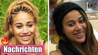 Fürs Lächeln: Sarah Joelle lässt sich Zahnfleisch weglasern