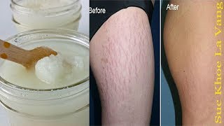 Rạn da đến đâu cũng sẽ mờ dần rồi mất hẳn với 7 cách làm này