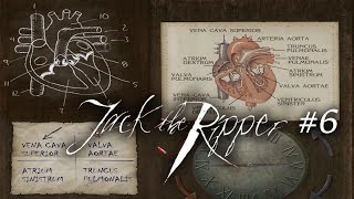 Шерлок Холмс против Джека Потрошителя - Анатомия сердца. Часть 6