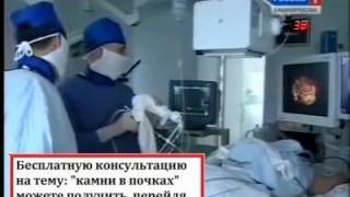 Камни в почках удалять можно без разрезов