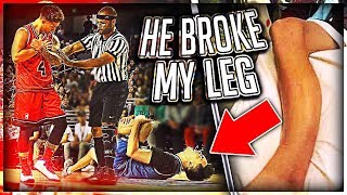 He Broke My Leg At Ace Family Event (Charity Basketball Highlights)
