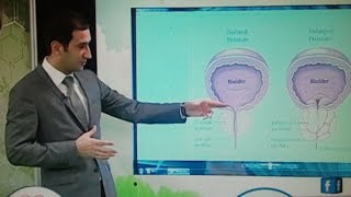 Dr Seymur Mehtiyev - Sağlıqla - Prostat vəzi xəstəlikləri haqqında (2015)