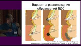 ЭНДОСКОПИЯ В ДИАГНОСТИКЕ ЗАБОЛЕВАНИЙ БДС. ШКОЛА HPB ХИРУРГИИ. КБ № 122.