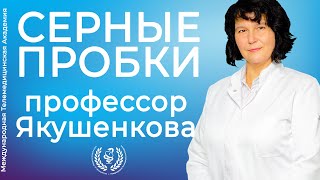 Серные пробки (ушные пробки)? | ЛОР [2019]✅