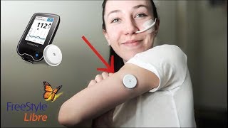 ♡ Testing the FreeStyle Libre Sensor + Draining my Stomach! (26.06.18) | Amy's Life ♡