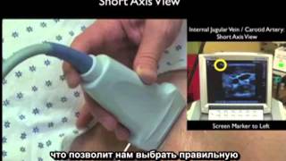 Порядок выполнения: центральный венозный доступ под контролем ультразвуковой визуализации (часть 1)