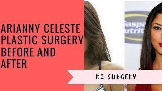 Arianny Celeste Plastic Surgery Before and After