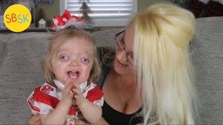 Growing Up with Pfeiffer Syndrome (A Normal Kid Who Looks a Bit Different)