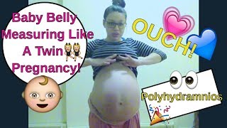 Ouch! The Pain! Huge Singleton Baby Belly Measuring Like A Twin Pregnancy | Polyhydramnios