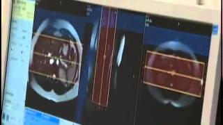 висцеральный жир - что видно внутри при обследовании