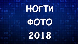 ДИЗАЙН НОГТЕЙ ГЕЛЬ ЛАКОМ 2018 | ЛЕТНИЙ МАНИКЮР 2018