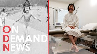 'Napalm Girl' Finally Puts Vietnam War HORROR Behind Her