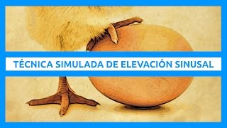 Técnica simulada de elevación sinusal