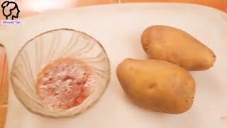 আলুর  দিয়ে,রোদে পুড়া ভাব/ ব্রনের দাগ/ কালো দাগ দূর করুন  using potato  remove sun tan black spot