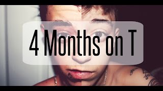 FTM Trans Man - 4 Months on Testosterone
