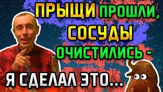 ПРЫЩИ ПРОШЛИ, ОЧИСТИЛИСЬ СОСУДЫ - Я СДЕЛАЛ ЭТО... Островский, жкт, ромашка, ответы на вопросы