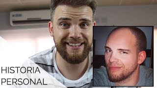 UNA HISTORIA PERSONAL: ¿Tengo que tomar pastillas para el pelo para toda la vida?