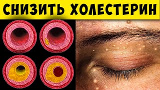 Тревожные симптомы «Плохого» Холестерина! СуперЕда чтобы снизить Холестерин