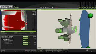 Ортопедическая стоматология. Компьютерное моделирование виниров CAD/CAM