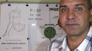 Сильная потливость ладоней.
