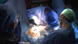 Opération de cœur ouvert avec Innovation Technique de Remplacement  valve sans ouvrir le thorax