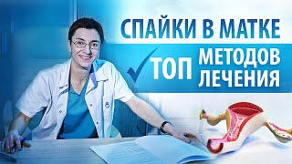 Синдром Ашермана. Внутриматочные синехии. Как с ними бороться?