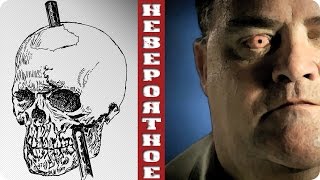 Самые невероятные случаи в медицине !