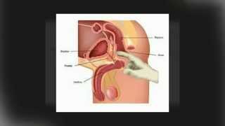 Orgasme de la prostate