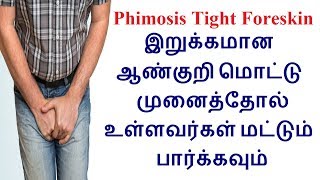 Phimosis Tight Penile Foreskin causes diagnosis treatment and prevention in Tamil