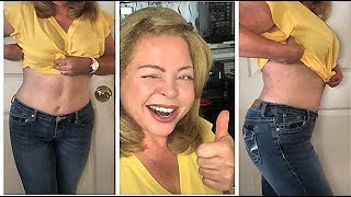 Такой у меня живот после абдоминопластики! Показываю