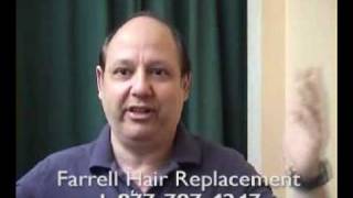 Hair Replacement - Spotting A Bad Hair System