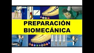 "PREPARACIÓN BIOMECÁNICA" por el Dr. Luis Caffo