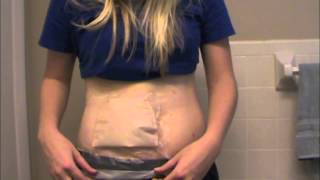 How To Keep Ostomy  Dry In The Shower