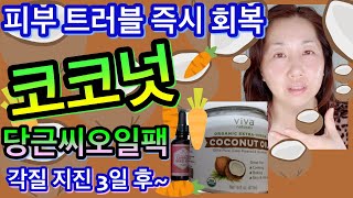 코코넛오일 피부 사용법⎪코코넛 ?당근씨?오일 피부 진정 보습팩⎪당근씨 캐롯씨드 오일 사용법⎪뒤집어진 피부 복구⎪건조 트러블 피부 진정 마스크팩 만들기⎪페이스오일 사용법 바르는 순서