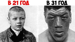 Единственный человек в истории, который родился карликом, но затем стал гигантом