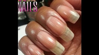 Nail Ridges? Treat Them W/ This Moisturizing Soak!